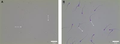 Alpha-lipoic acid improves the quality of ram spermatozoa stored at 4°C by reducing oxidative stress and increasing mitochondrial potential